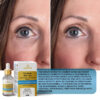8D Hyaluronic Acid Complex