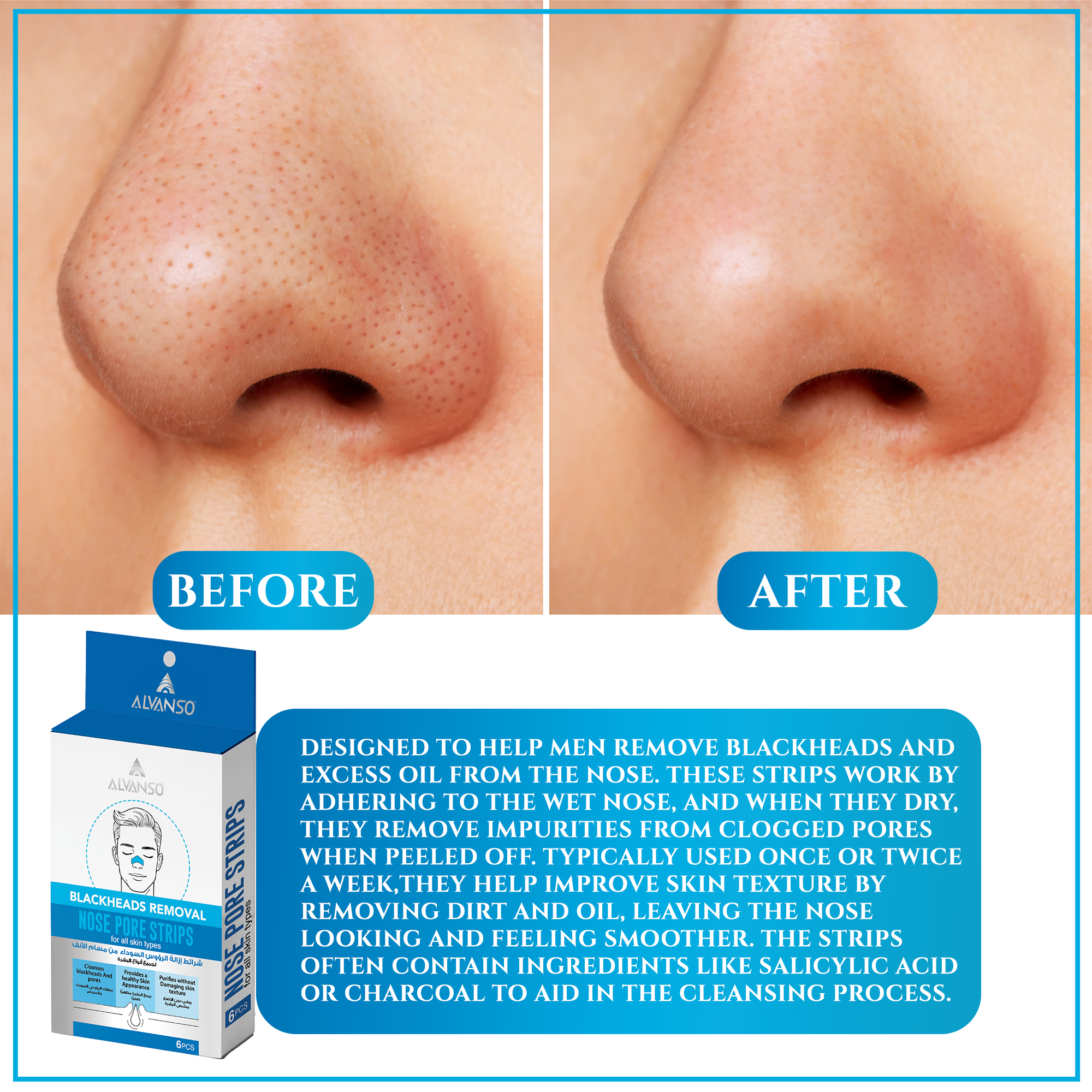 NOSE PORE STRIP
