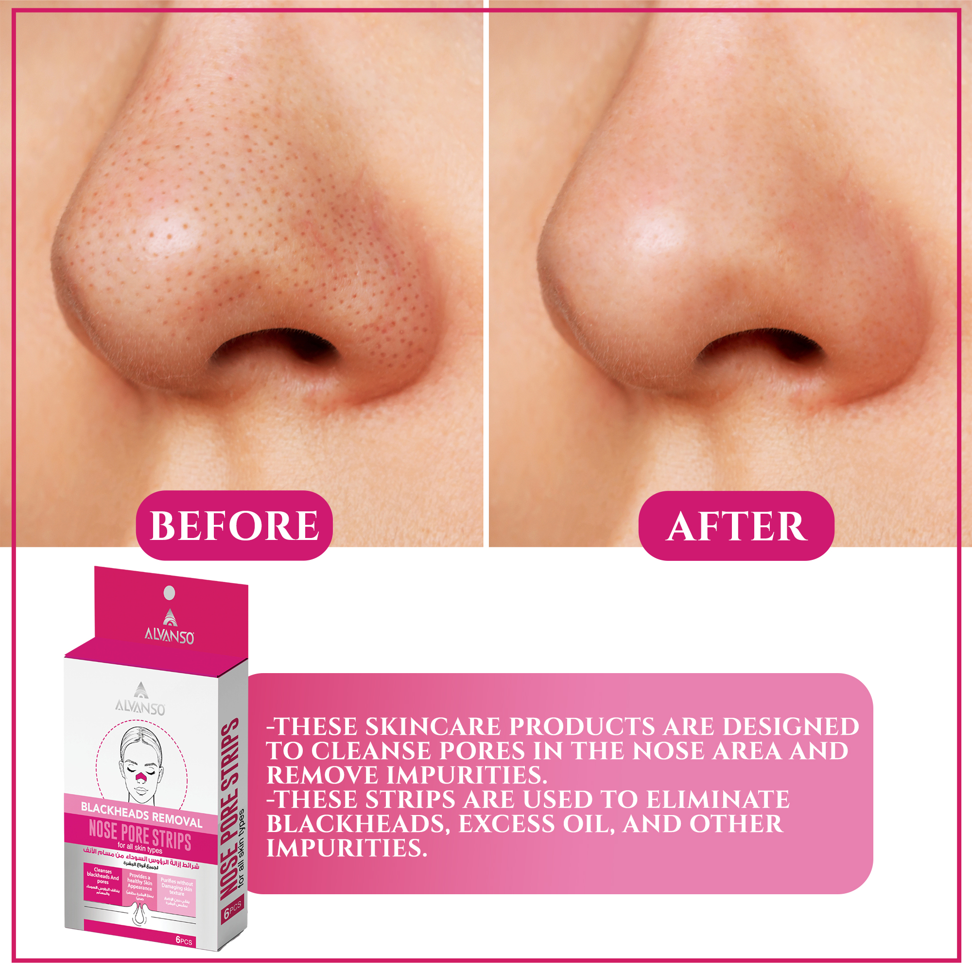 NOSE PORE STRIPS